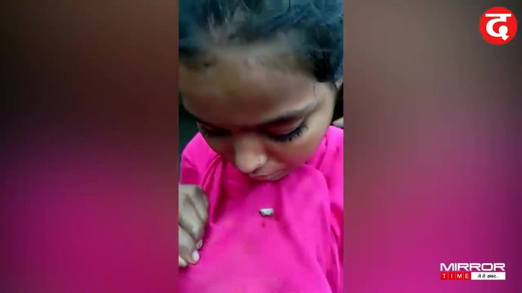 Girl cries STONES instead of tears (15 साल की किशोरी आंख से उगल रही पत्थर)