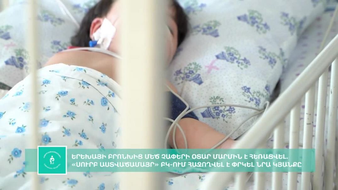 «Սուրբ Աստվածամայր» ԲԿ-ում 10 ամսական երեխայի բրոնխից մեծ չափերի օտար մարմին է հեռացվել