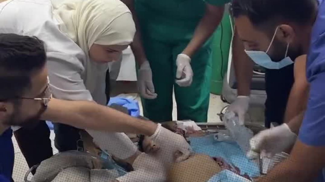 Բժիշկները փորձում են փրկել Գազայի հատվածում վիրավորված երեխայի կյանքը